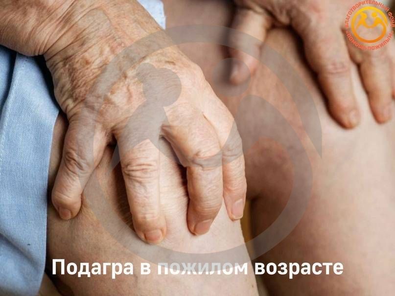 Подагра в пожилом возрасте