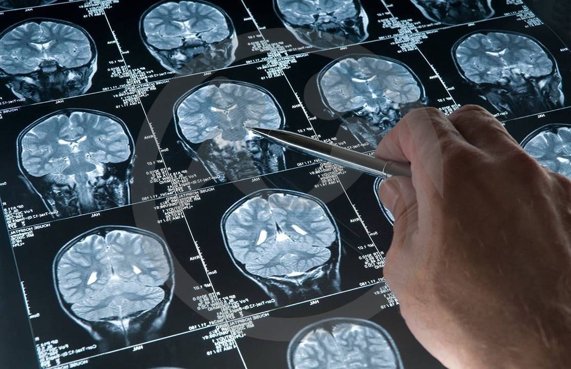  Исследование: ликвор как источник вечной молодости